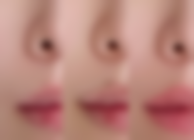 北海美秀中禾医疗美容门诊部顾客实例