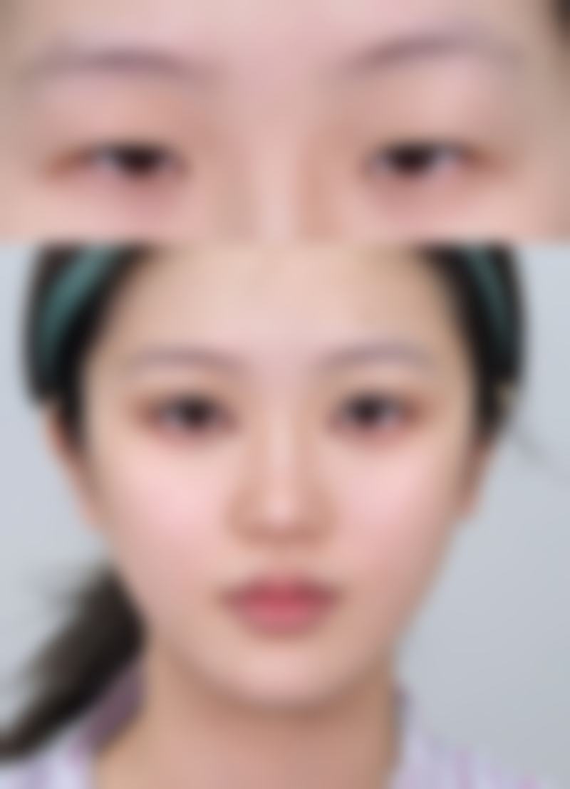 去完眼袋有皱纹怎么办之生活习惯调整：从源头狙击皱纹