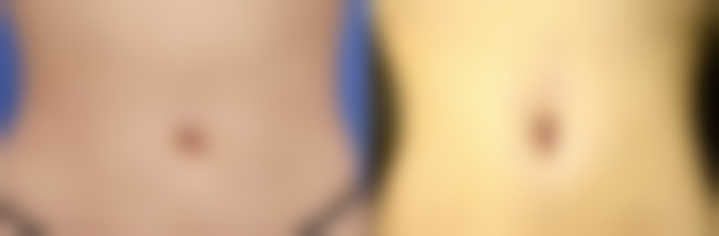 扬州俏华美医疗美容诊所高军飞2026坐诊情况——扬州王金美口腔门诊部