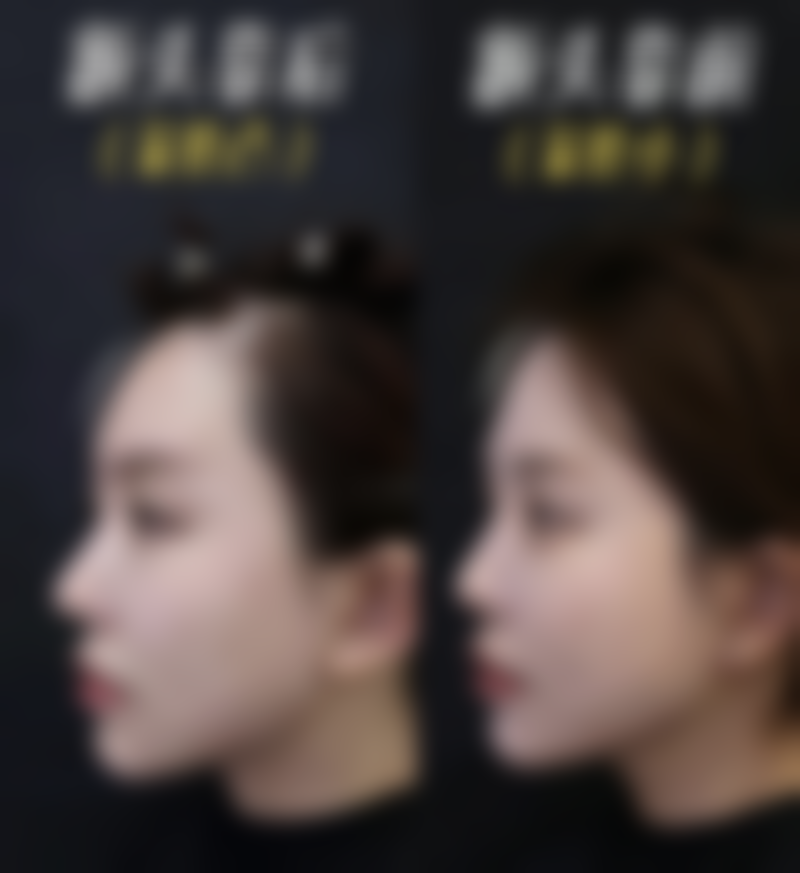 李金凤医生简介医生顾客实例图片