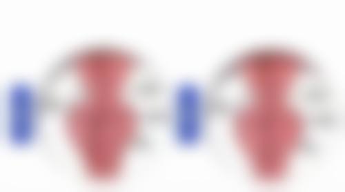 做完双眼皮眼睛和眉毛更近了怎么办？专业医生教你修复方案+脂肪填充技巧