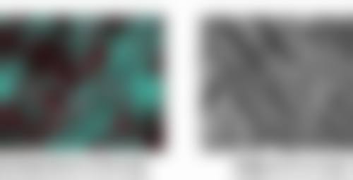 全切双眼皮疤痕修复时间表大公开