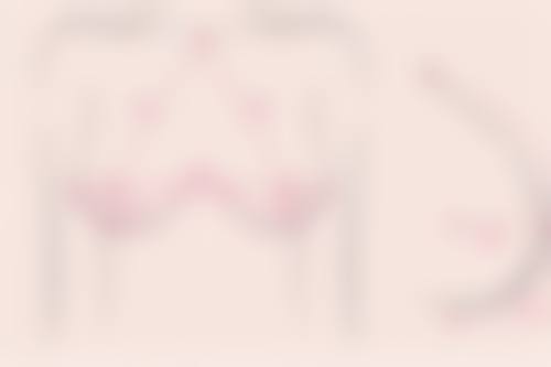 深圳米兰柏羽医疗美容整形门诊部怎么样