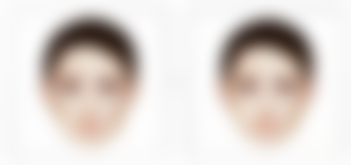 隆鼻打什么消炎针成效更好——青霉素类消炎针:经典老牌的可靠之选