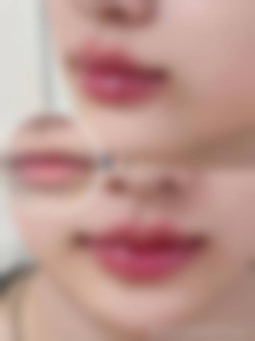 随州博奥医疗美容诊所怎么样更擅长什么