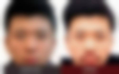 赵章杰医生简介做手术价格