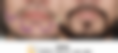 舒惠恺医生怎么挂号