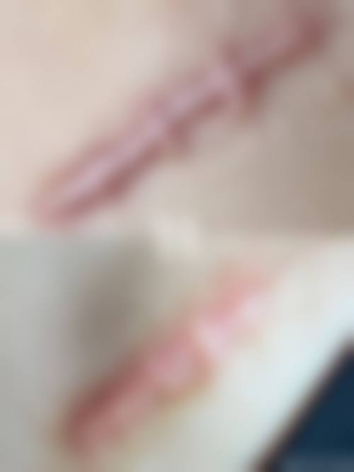 党广轩医生做手术价格