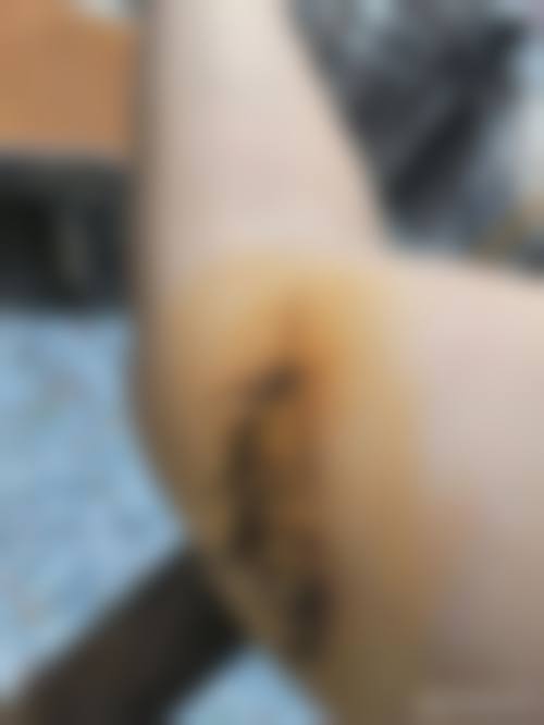 天津伊思贝整形怎么样,医生详细介绍