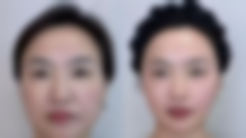 伊宁市人民医院冉奎峰医生简介及优势