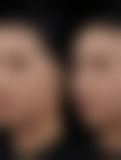 焦作时代女子医院整形美容中 心口碑好不好?附真实患者口碑评价