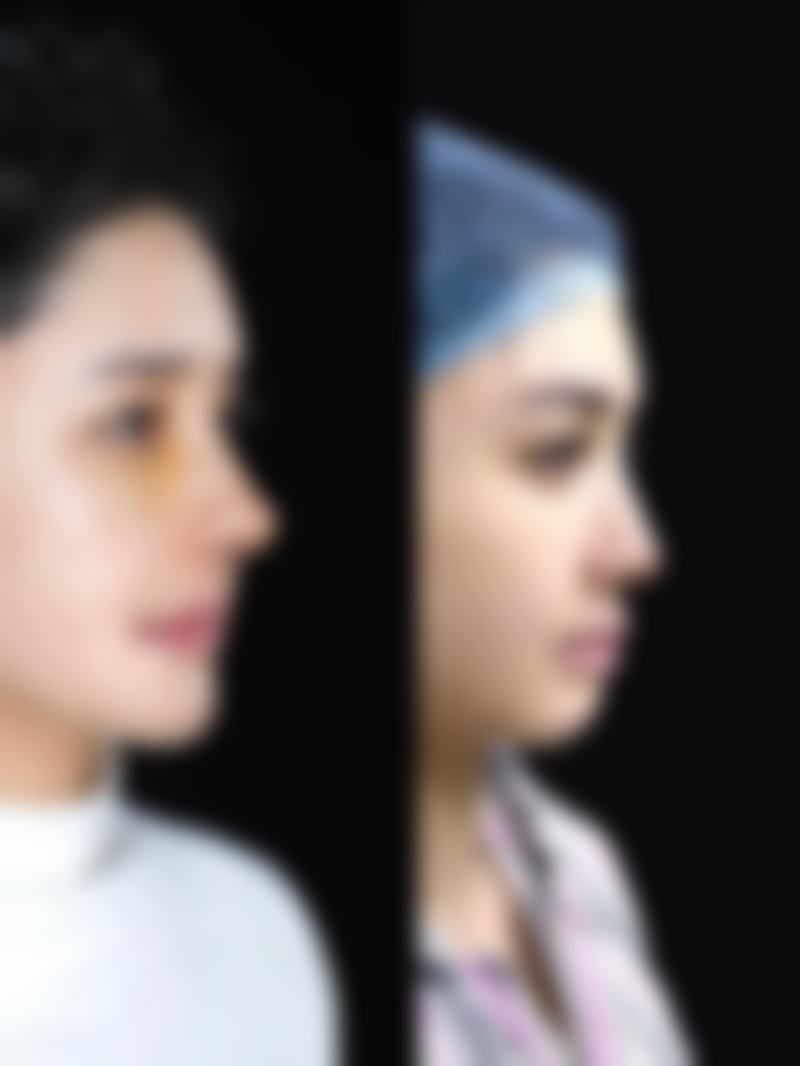 焦作时代女子医院整形美容中 心怎么样,口碑评价如何?