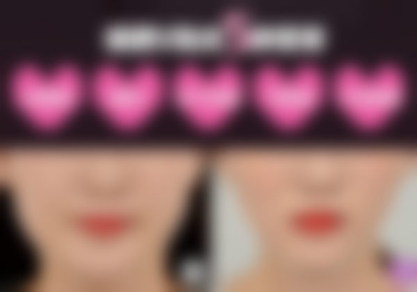 四、韩国(ATOP)爱她整形外科医院项目特色怎么样