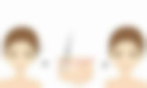 四、烫伤留下的深度疤痕会消掉吗