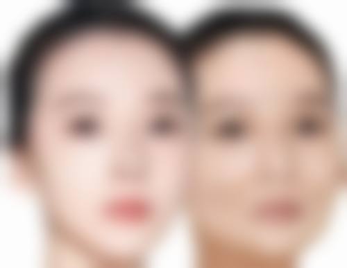 上海芙艾智妍医疗美容诊所价格表