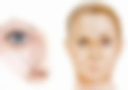 哪些手术可以去眼袋——射频消融法：热能小能手的精细打击