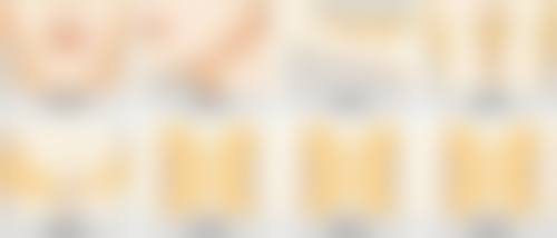 做完眼袋出现疤痕增生可以下去吗？3个月自然消退+激光修复全攻略