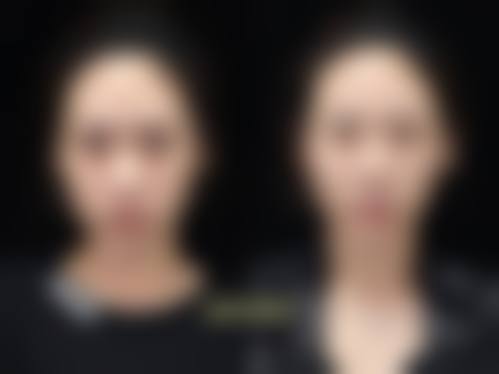 赵琼医生简介做手术价格