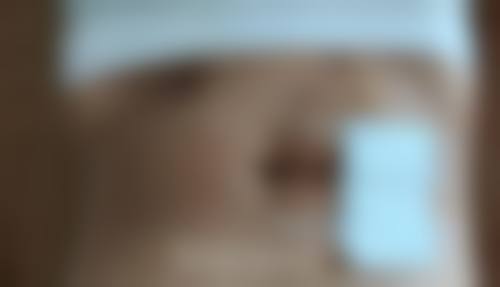 武汉媄妲医疗美容抖音团购活动及价格表