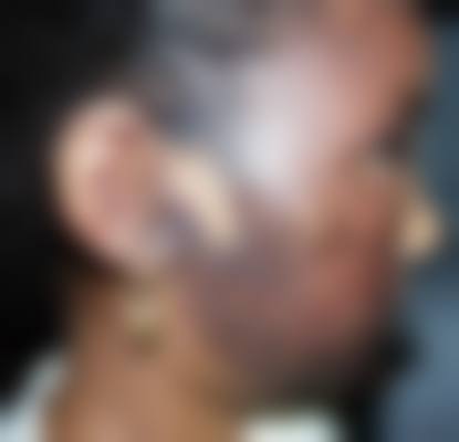 陕西省汉中市海天医疗整形美容抖音团购活动有哪些,价格表