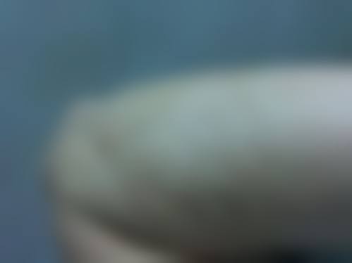 郑州大学第五附属医院整形外科价格表