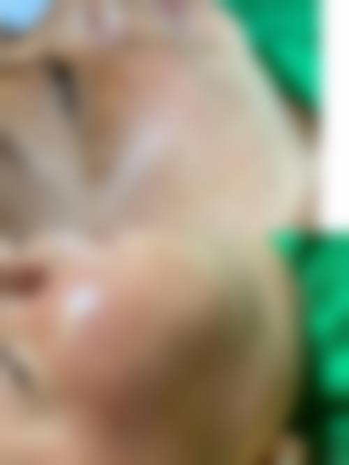 洛阳王妃医疗美容医院口碑好不好?附真实患者口碑评价