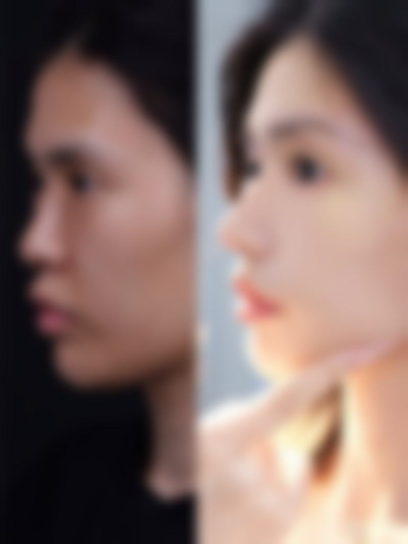 广元医而美美华医疗美容整形门诊部怎么样，更擅长什么