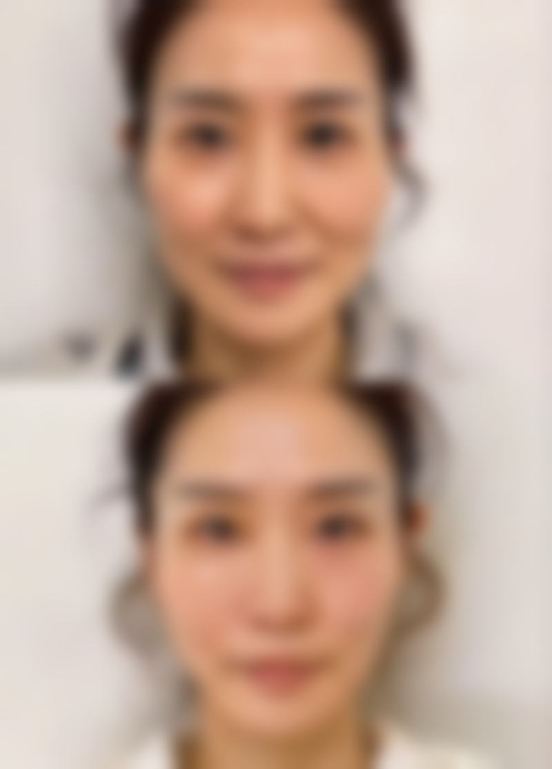 卢宏医生简介之做手术价格