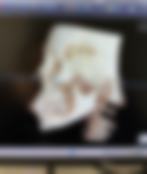 后天眼袋成都中医去除：古老智慧的现代应用