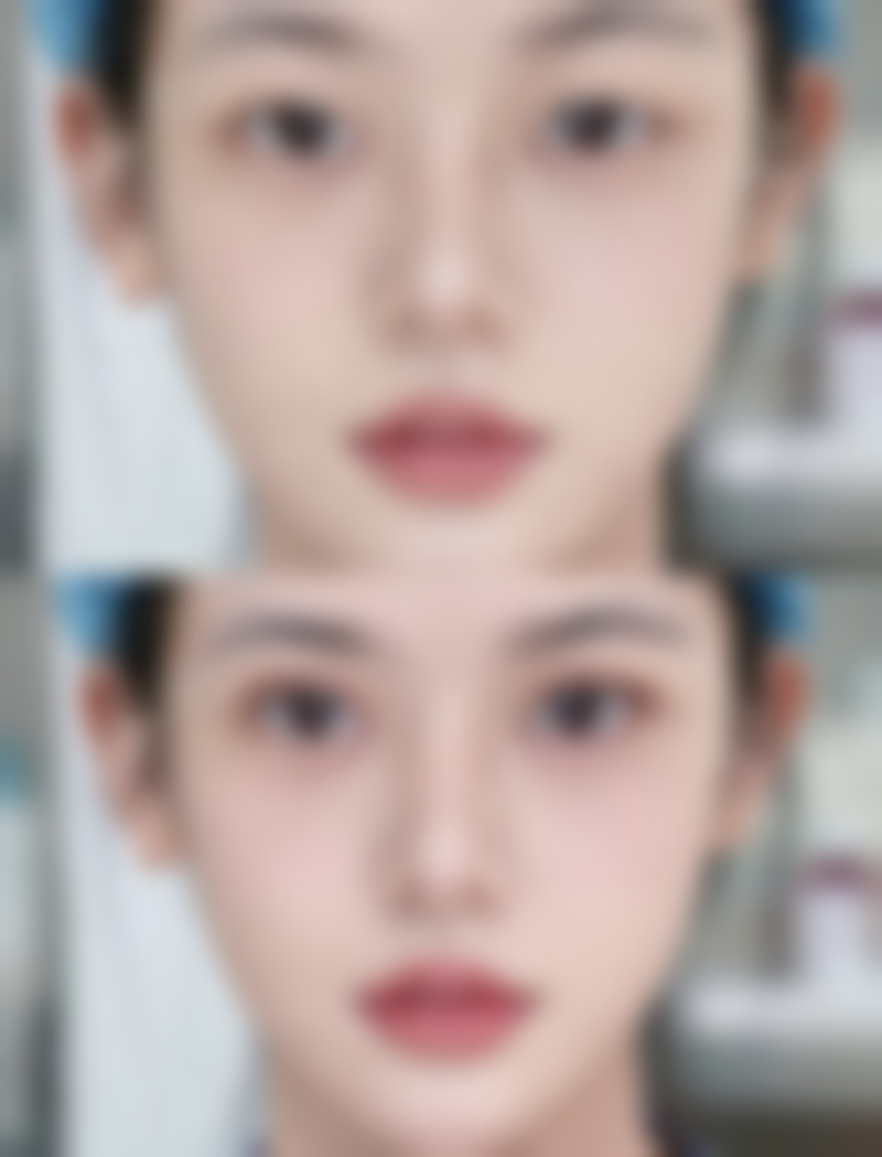 瘦脸针下巴一起打脸会变小吗：共同注射注意事项全知道