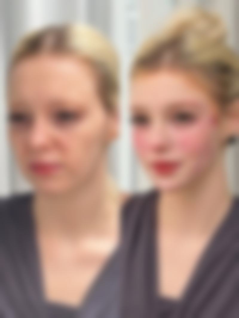 运动助力——改善黑眼圈眼袋的运动方式