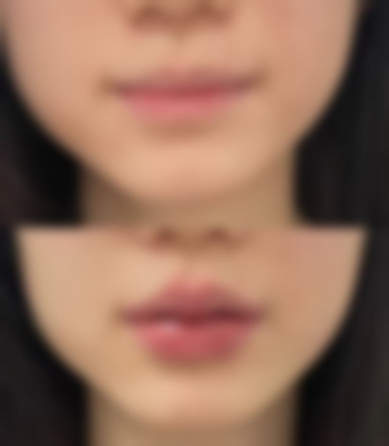 李瑶医生顾客实例图片