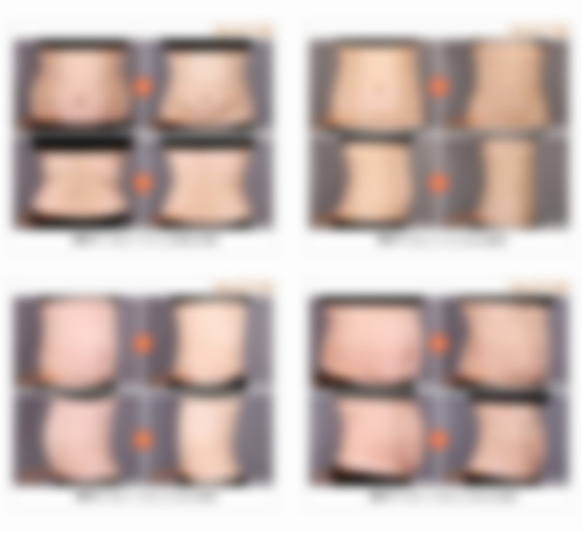 韩国365mc吸脂医院医生简介