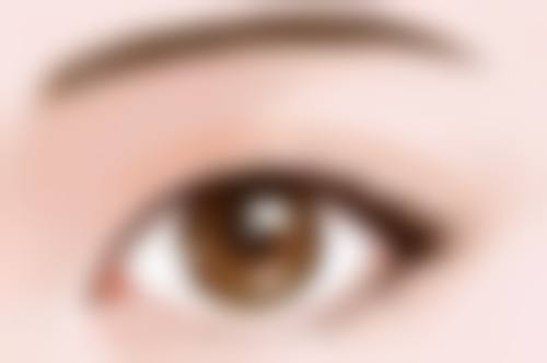 四、隆鼻线提升取出方法详解