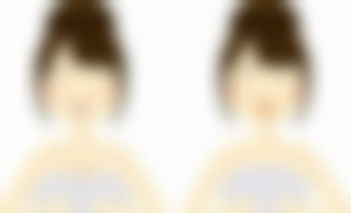 二、隆鼻线提升不取出变形风险分析