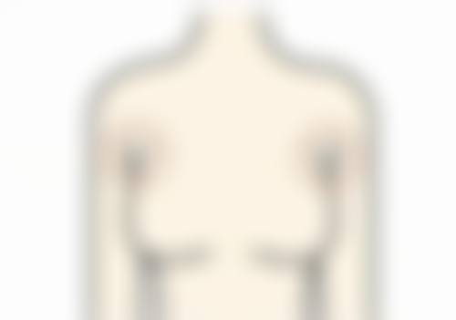 黎小妮医生简介做手术价格