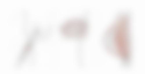 全切双眼皮医生哪好之不错技术骨干医生风采