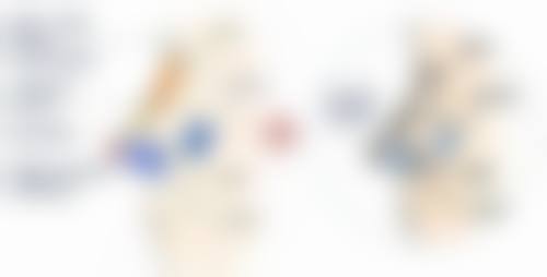 埋线全切双眼皮修复成效哪好之术后护理至关重要