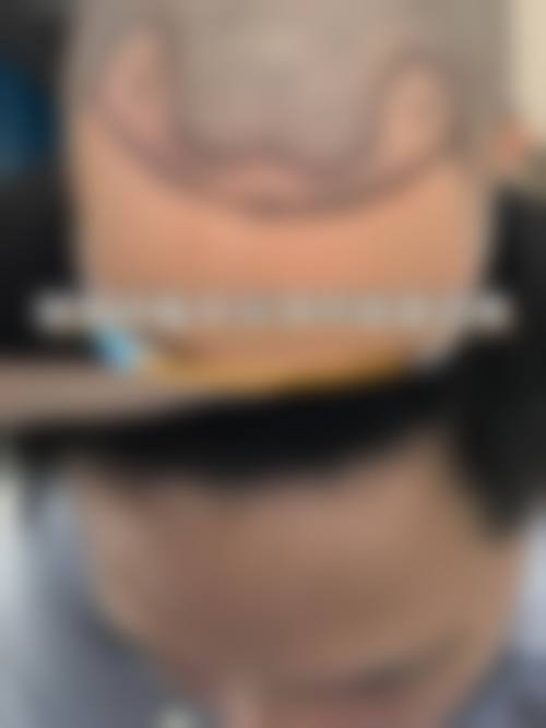 喀什西妃美熙霏整形医院怎么样，口碑评价如何？