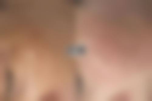 黄志鹏医生顾客实例图片情况