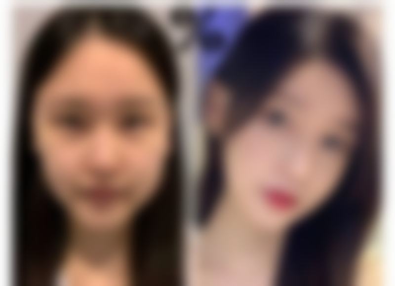 冯露医生做手术价格