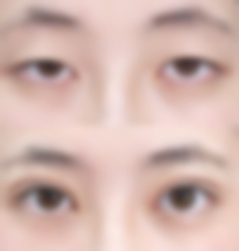 冯露医生怎么挂号