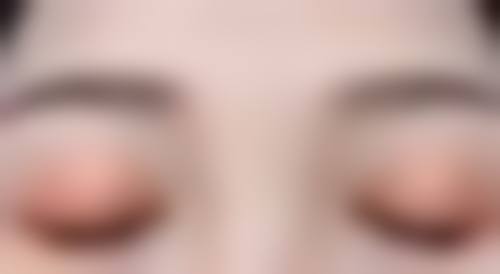 吸脂成效的长期维持策略