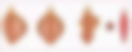 减肥后出现眼袋怎么办之进阶护理方案