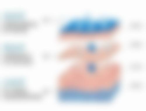 50岁做双眼皮全切的注意事项有哪些