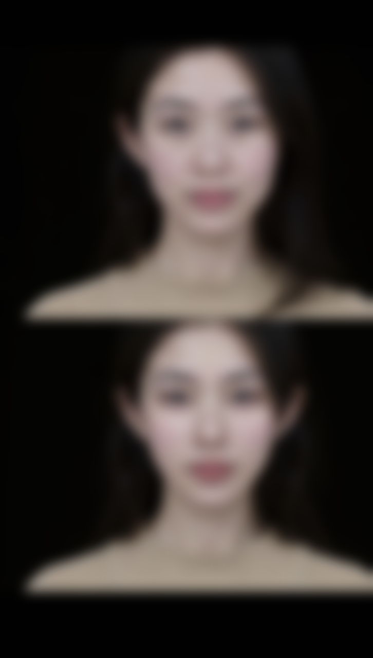 林富强医生做手术价格