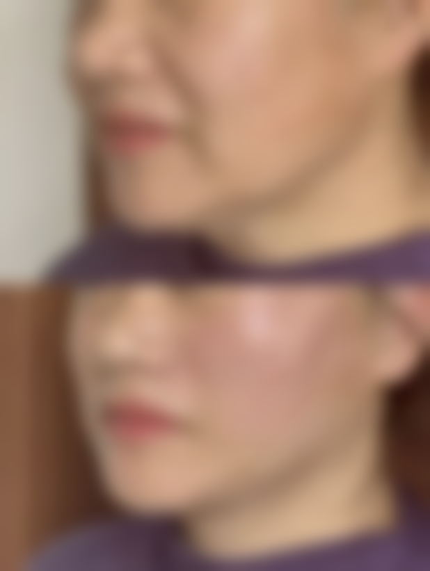 盛飞医生项目优势