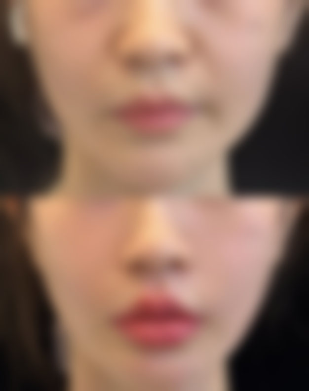 重庆叶熹整形医院地址及乘车路线