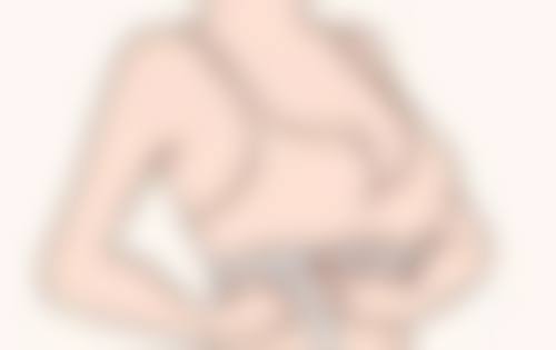 疤痕修复产品手术疤痕增生科学选择：慧眼识珠