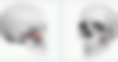 怎么有效去除熬夜型黑眼袋：从作息到护理